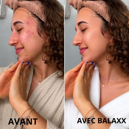 pommeau de douche filtrant haute pression