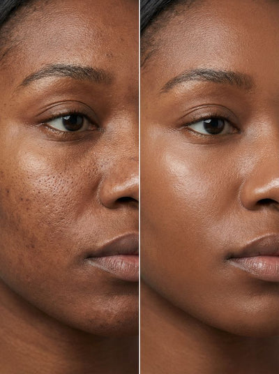 Une eau plus agréable pour votre peau